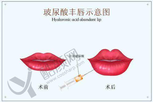 八、杭州星璨医疗美容医院真实的顾客评价如下: