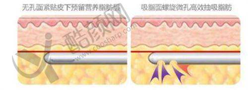 二、杭州星璨医疗美容医院正规吗?来看看医院资质: