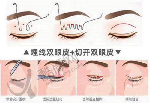 罗飓元项目价格表参考