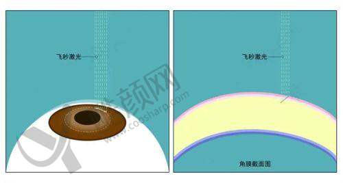 光明眼科医院抚州在哪里——贴心服务暖人心