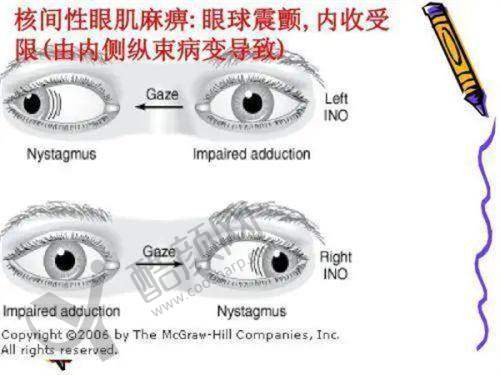 泉州艾格眼科的精良设备