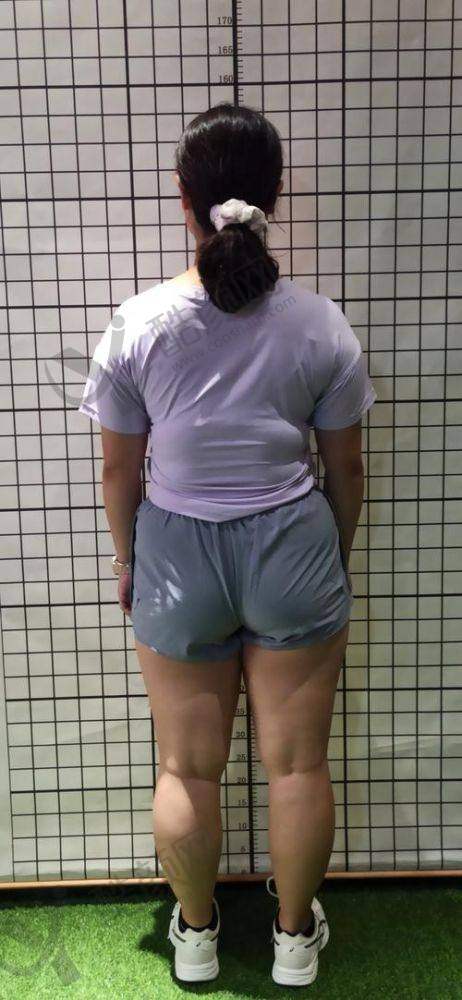 一、杭州星光丽格医疗美容门诊部怎么样？