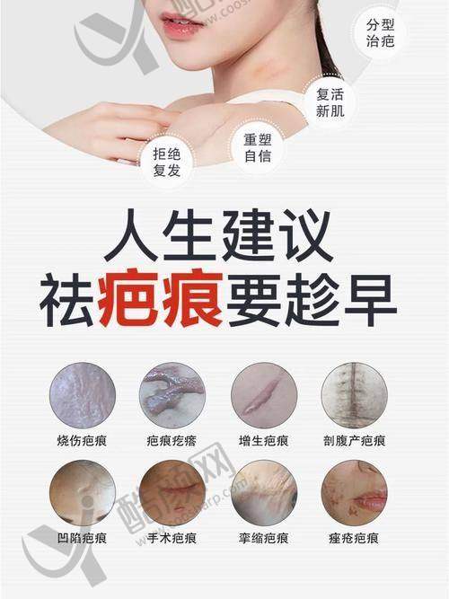 新疆纽菲思整形：烧烫伤修复的具有影响力之选