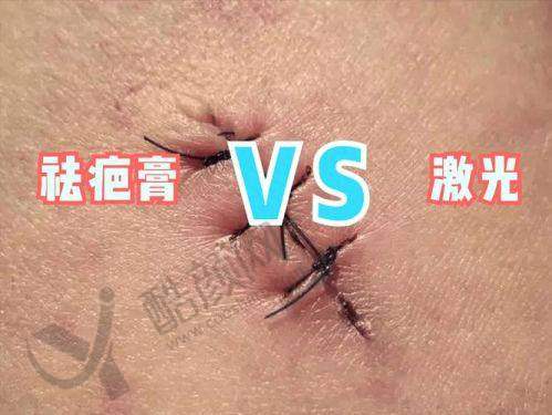 新疆黎美整形美容：老牌疤痕修复机构