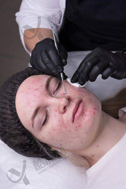 新疆威兹曼整形外科医院：德系技术的疤痕修复骨干医生