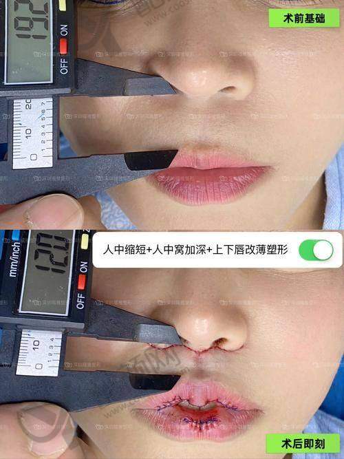 郑州双馨艺美医疗美容诊所：骨干医生团队经验多