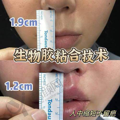 郑州陇海医院医学整形科：综合医院保护高