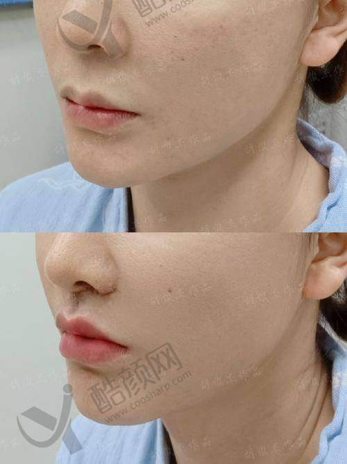 郑州明眸医疗美容诊所：技术与满意度双高