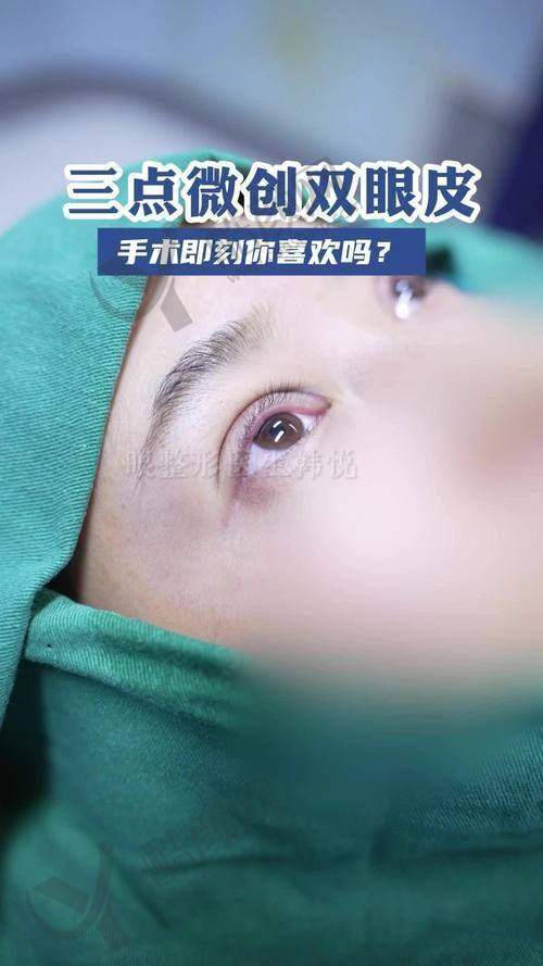 浦雯雯医生的擅长项目与技术特点