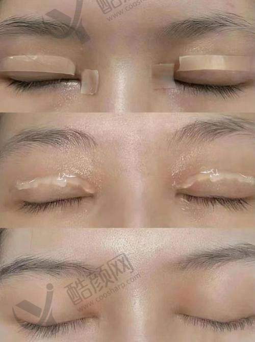 浦雯雯医生：专精实力实力强