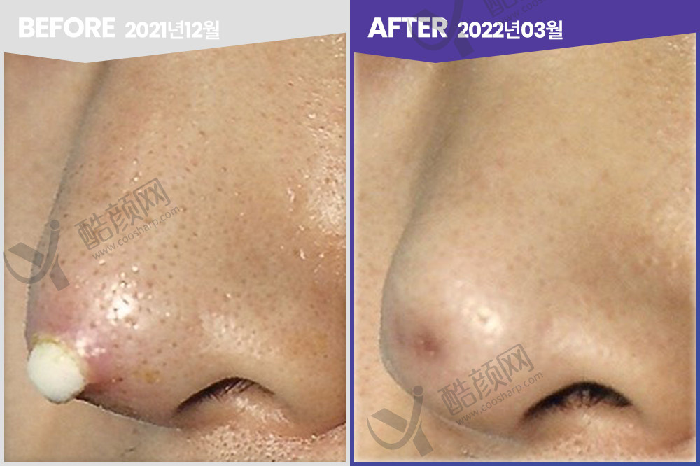 韩国宝尼达整形外科环境图