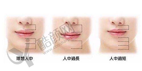 谭拯医生人中缩短手术预约流程