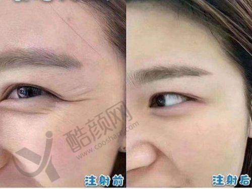 七、沈阳医颜丽海医疗美容门诊部价格表：（仅供参考）