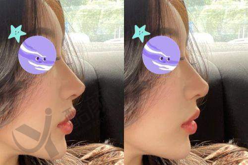 深圳刘冰怎么预约?