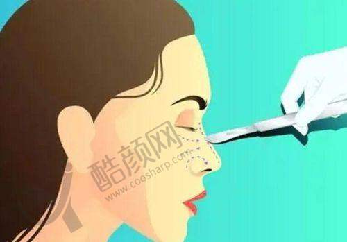 深圳刘冰做鼻子怎么样?