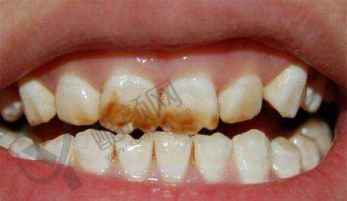 五、江西抚州医学院附属口腔医院怎么预约：