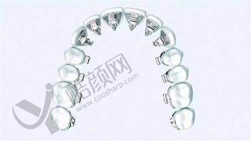 成人深覆颌矫正:提升咀嚼效率势在必行