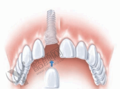 三、江西抚州医学院附属口腔医院医生介绍: