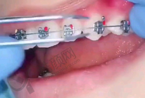 沈阳九诺口腔的贴心服务