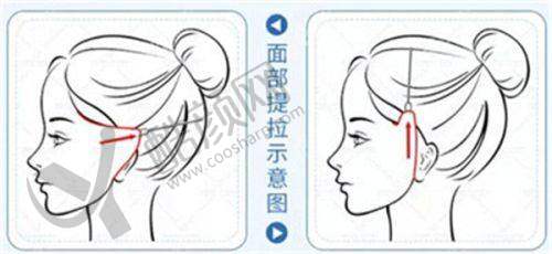 六、沈阳医颜丽海医疗美容门诊部怎么预约：