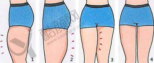 六、深圳宝安中 心医院整形美容科怎么预约: