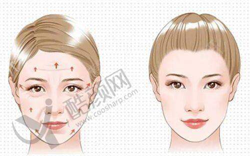 杨东运口碑和评价