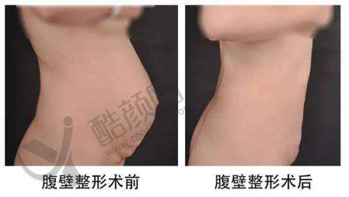 四、沈阳医颜丽海医疗美容门诊部实例