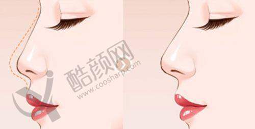 一、北京瀛美医疗美容门诊部怎么样?