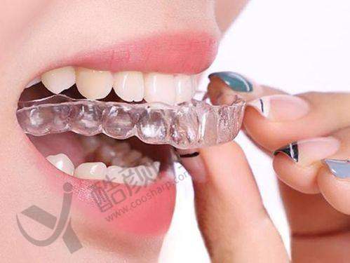 成人深覆颌矫正:预防关节疾病迫在眉睫