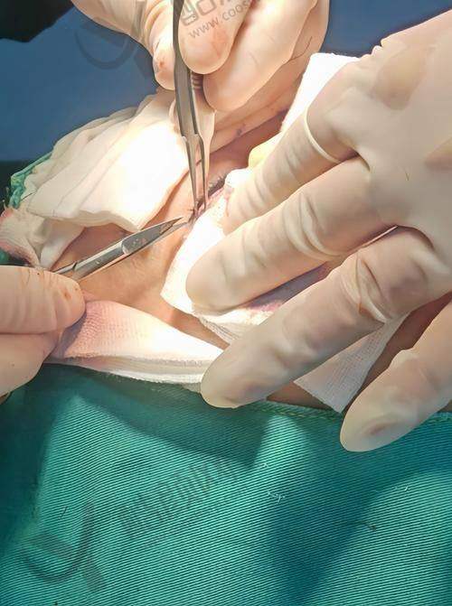 张海明医生预约方式揭秘