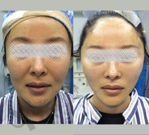 张海明医生口碑评价