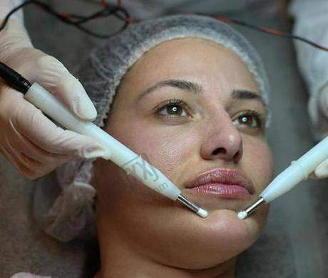 广州研媄荟聂云飞深平面拉皮提升实例