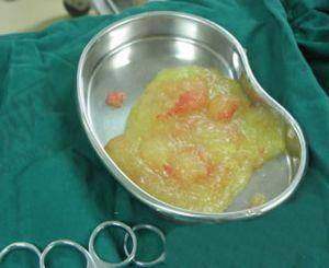 杨庆华医生：患者反馈成效显著