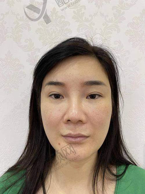 冯雁平医生成功实例与口碑评价