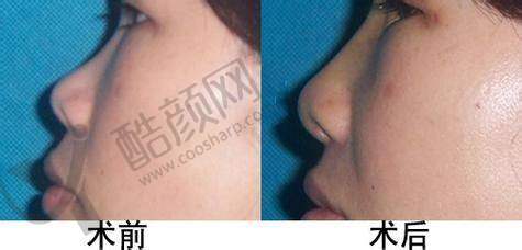 冯雁平医生技术优势